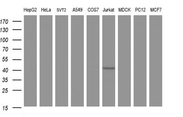 Monoclonal Mouse anti-Human SEPT1 / Septin 1 Antibody (clone OTI1E1, WB)