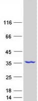 Human NMRAL1 / HSCARG Protein (Recombinant Myc-DDK (Flag))
