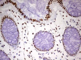 Monoclonal Mouse anti-Human HNRPM / HNRNPM Antibody (clone OTI3F3, aa1-261, IHC, WB)