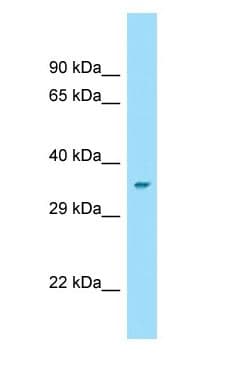 GMDS / GMD Antibody (aa268-317)