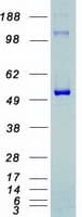 Human CDK8 Protein (Recombinant Myc-DDK (Flag))