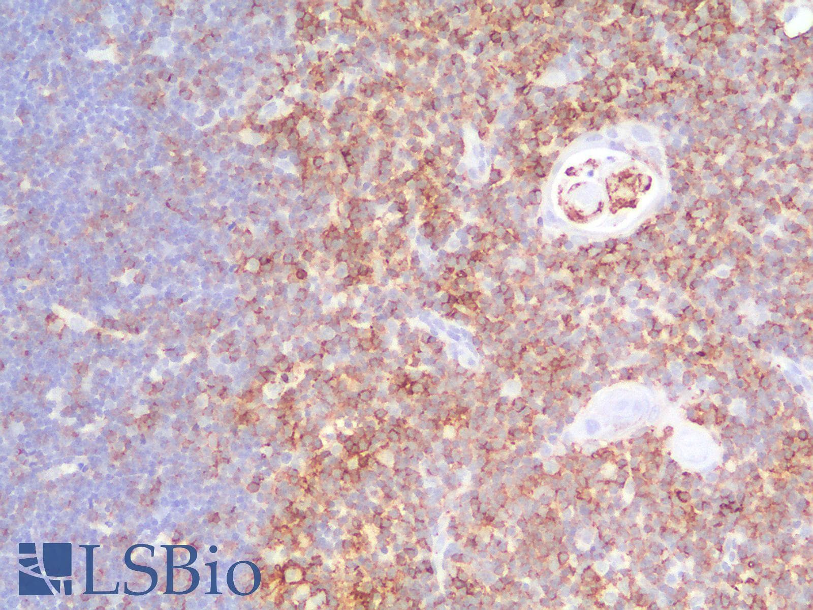 PathPlus™ CD44 Antibody (clone HCAM/2875R)