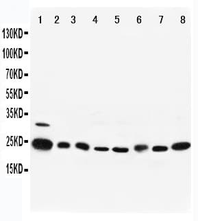 RAB5A / RAB5 Antibody (aa138-155)
