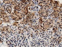 AK5 / Adenylate Kinase 5 Antibody (clone OTI2F9)