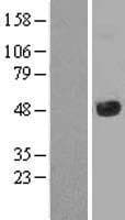 KDM8 / JMJD5 / FLJ13798 Protein (Over-Expression Lysate Myc-DDK (Flag))