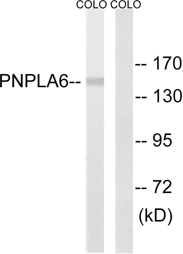 PNPLA6 / NTE Antibody