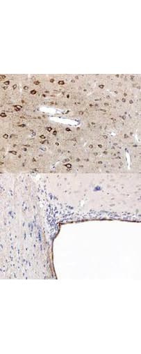 PPARA / PPAR Alpha Antibody (aa1-25)