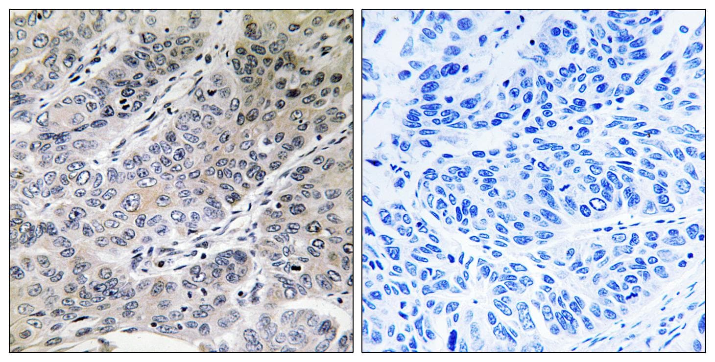 Brain Protein 44 / BRP44 Antibody