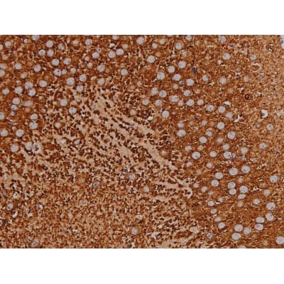 MAPT / Tau Antibody (phospho-Thr231)