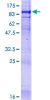 Human LBR / Lamin B Receptor Protein (Recombinant GST)