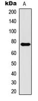 CPT1B Antibody (Internal)
