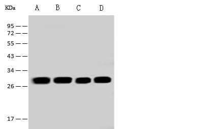 Polyclonal Rabbit anti-Human ETFB Antibody (IHC, IF, WB)