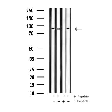 IKBKB / IKK2 / IKK Beta Antibody (phospho-Tyr199)