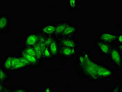 TRIP4 / ASC-1 Antibody