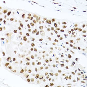 PRPF19 / PRP19 Antibody