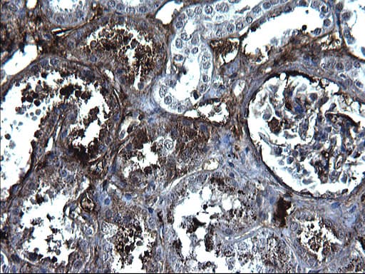 FGG / Fibrinogen Gamma Antibody (clone OTI5D7)