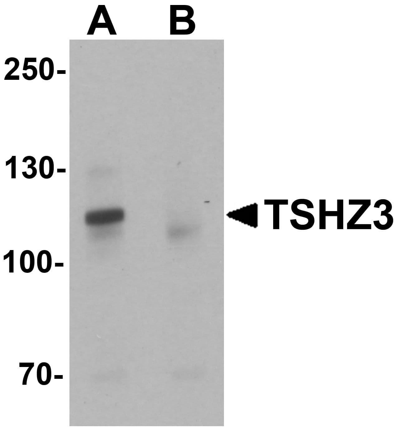 IHC-plus™ TSHZ3 Antibody