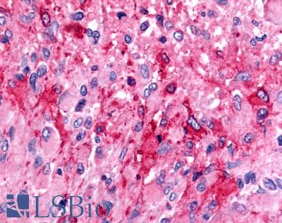 PathPlus™ Polyclonal Rabbit anti-Human TPRA1 / GPR175 Antibody (N-Terminus, IHC)