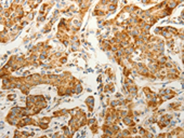 VDAC2 Antibody
