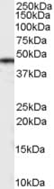 CSNK1D Antibody (aa310-324)