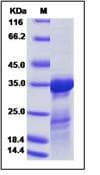 Influenza A Virus H3N2 Matrix Protein (Recombinant His, N-Terminal)