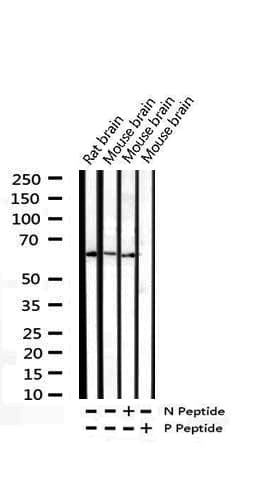 CDC25B Antibody (phospho-Ser323)