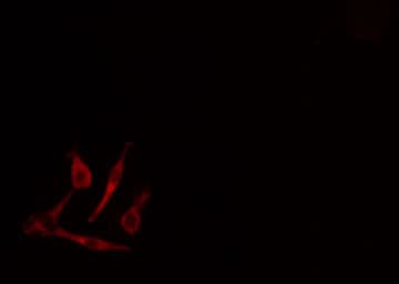 CYP19 / Aromatase Antibody