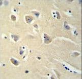 Proenkephalin / PENK Antibody (aa145-174)
