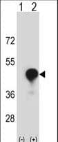 CD1C Antibody (aa226-253)