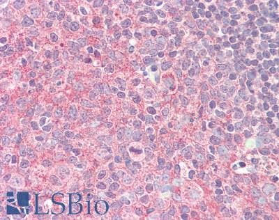 IHC-plus™ IL12RB1 / CD212 Antibody