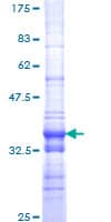 Human SMARCA2 / BRM Protein (Recombinant GST, N-terminus)