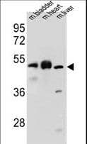 BTBD17 Antibody (aa411-440)