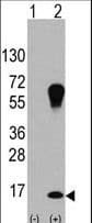 MAP1LC3A / LC3A Antibody