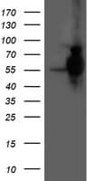 HARS2 Antibody (clone OTI5A9)