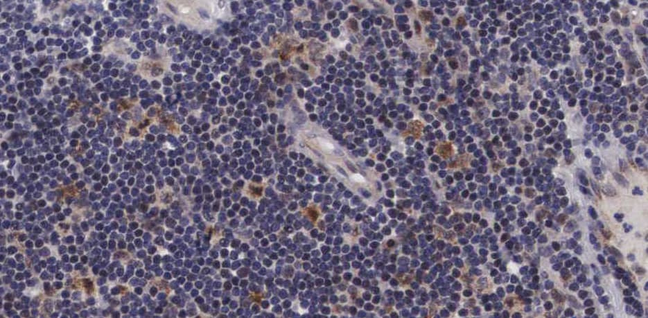 MAP3K5 / ASK1 Antibody (phospho-Ser966)