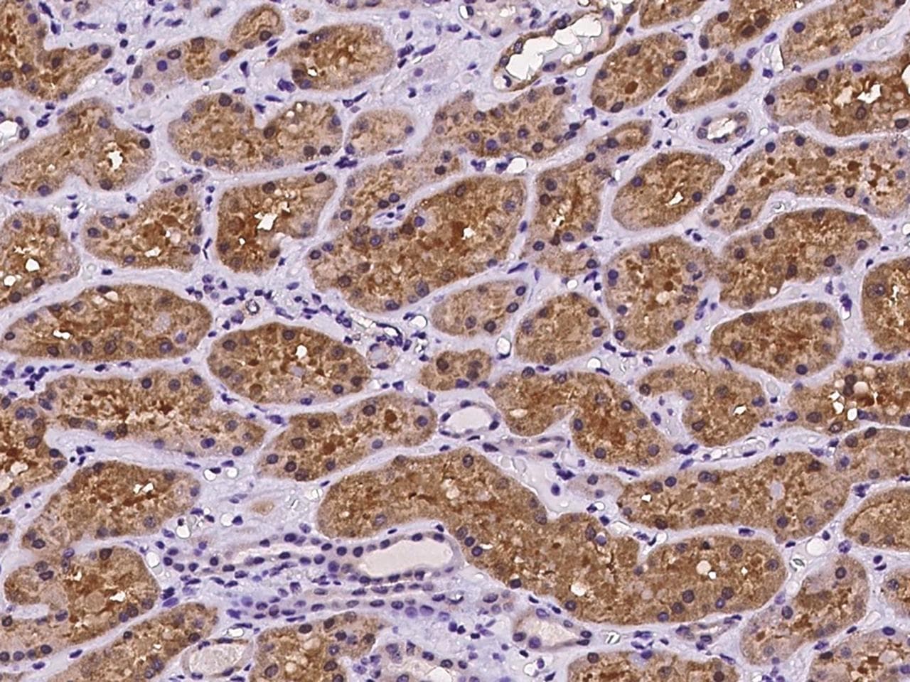 PEX13 Antibody