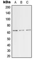 PathPlus™ TFE3 Antibody (Internal)