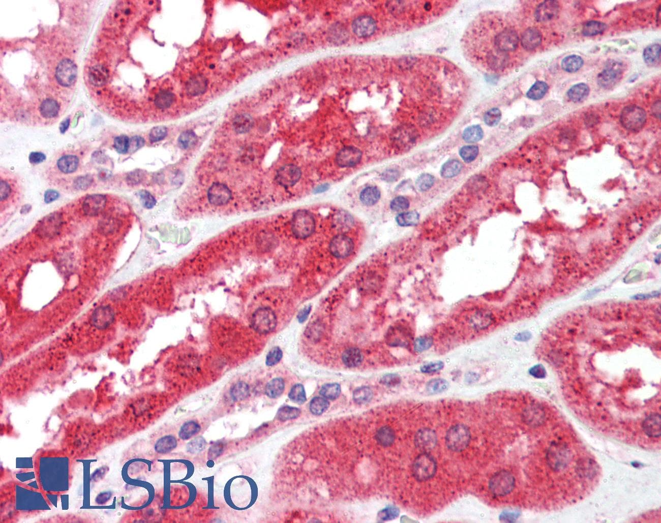 IHC-plus™ FGFR4 Antibody (clone 53CT32.19.3)
