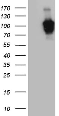 ZHX2 / RAF Antibody (aa595-837, clone OTI9A5)