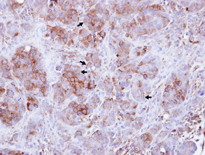 GBP3 Antibody (aa61-317)
