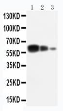 Polyclonal Rabbit anti-Human ADAM10 Antibody (aa612-627, WB)