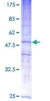 Human MAL2 Protein (Recombinant GST)