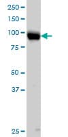 ITGB5 / Integrin Beta 5 Antibody (clone 2C4)