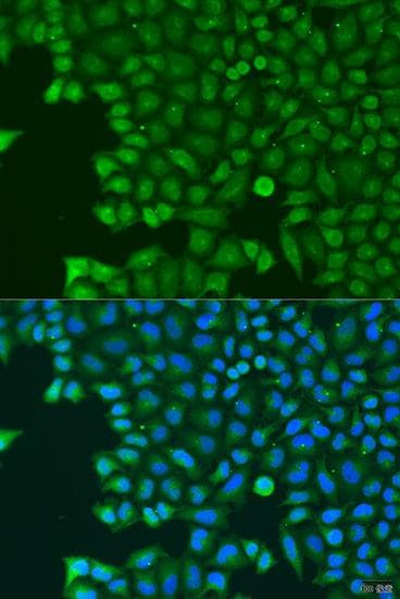 Polyclonal Rabbit anti-Human ABCE1 Antibody (IF)