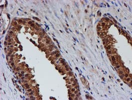 PSMB9 Antibody (clone OTI3F3)