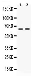 PVRL4 / Nectin 4 Antibody