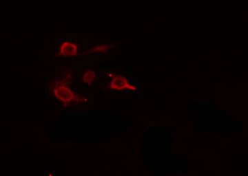 Polyclonal Rabbit anti-Human ARHGEF5 Antibody (IF, WB)