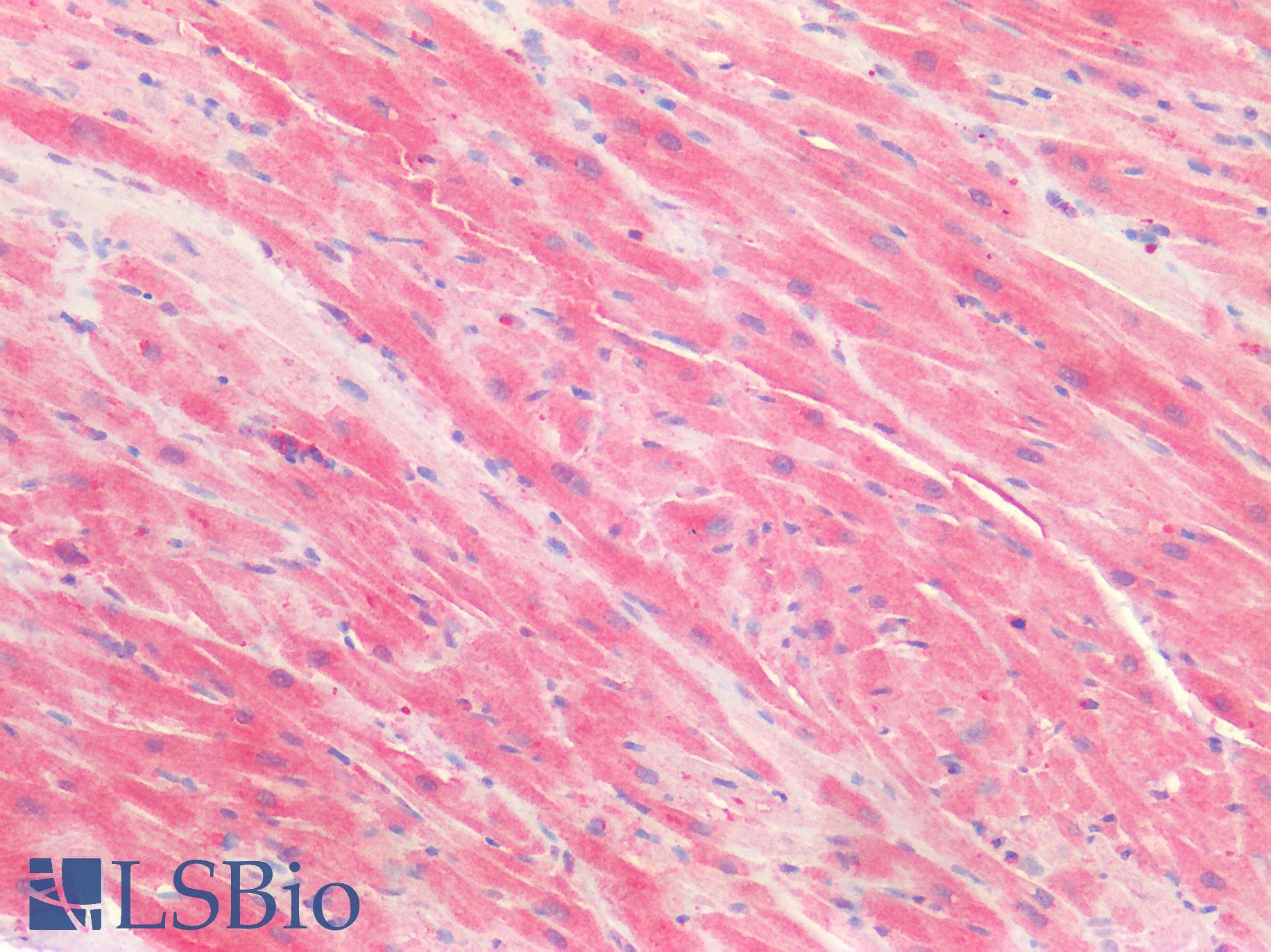 IHC-plus™ NUMB Antibody (aa638-651)