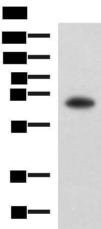 Polyclonal Rabbit anti-Human SHC3 / SHCC Antibody (IHC, WB)