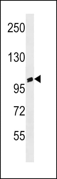 Polyclonal Rabbit anti-Human ANKRD20A3 Antibody (aa794-821, WB)